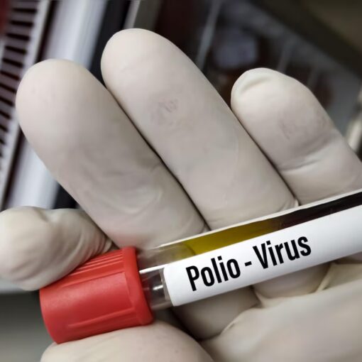 polio case