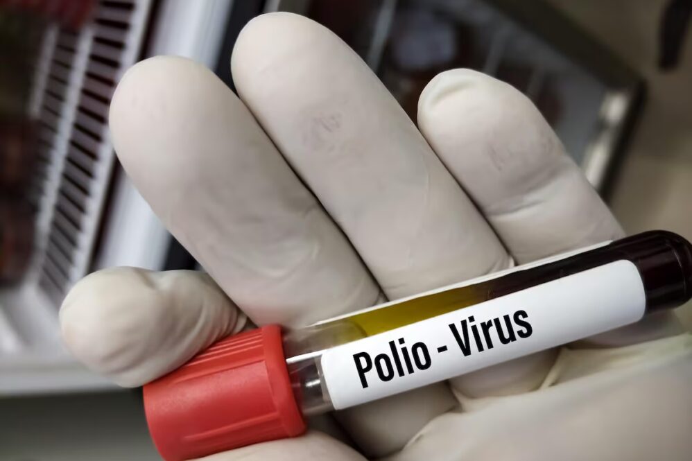 polio case