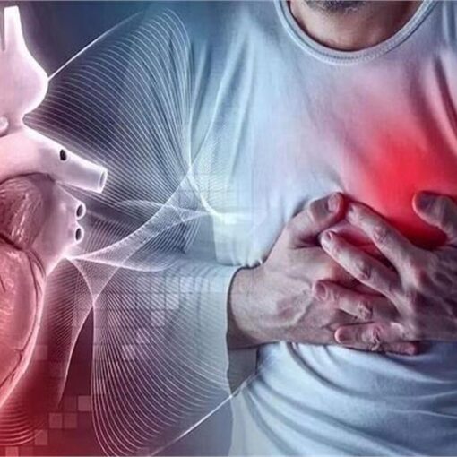 heart attack